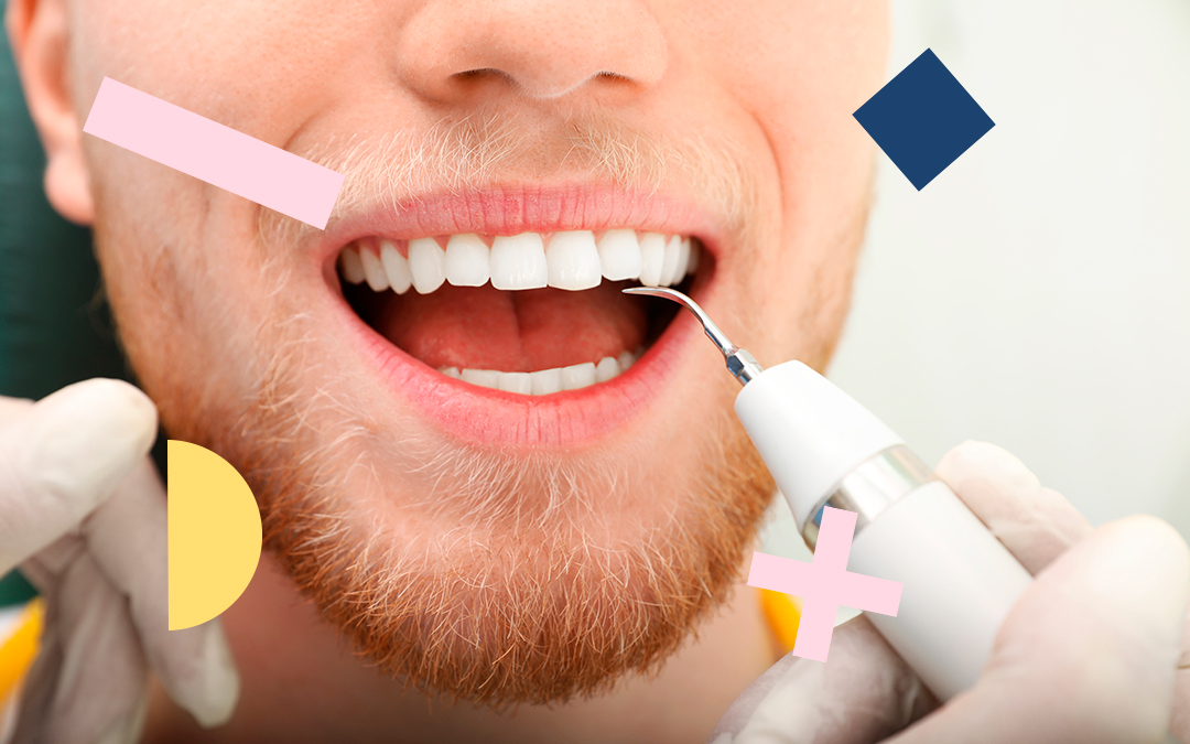 كيفية إزالة الجير من الأسنان مختبرات Kin