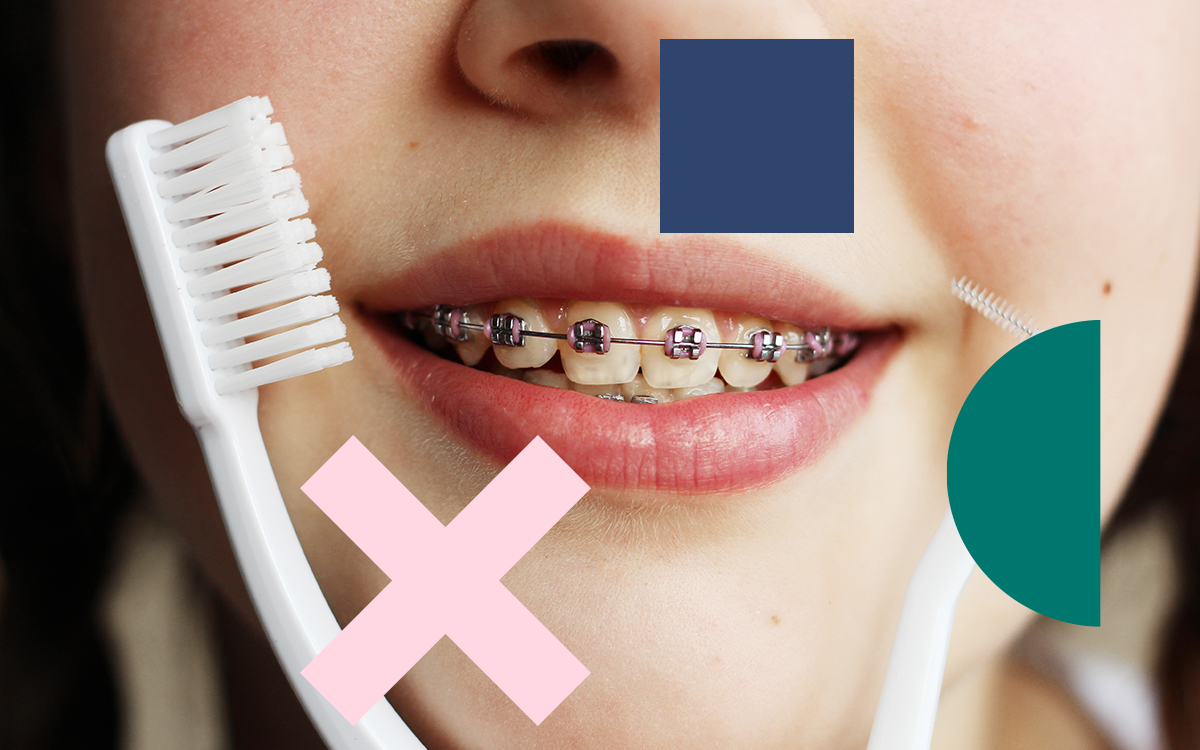 Prothèse dentaire : comment entretenir et fixer son appareil - Hygiène